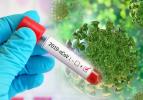 دکتر موید .......اثر تغذیه بر کووید 19 (Coronavirus disease 2019) قسمت اول